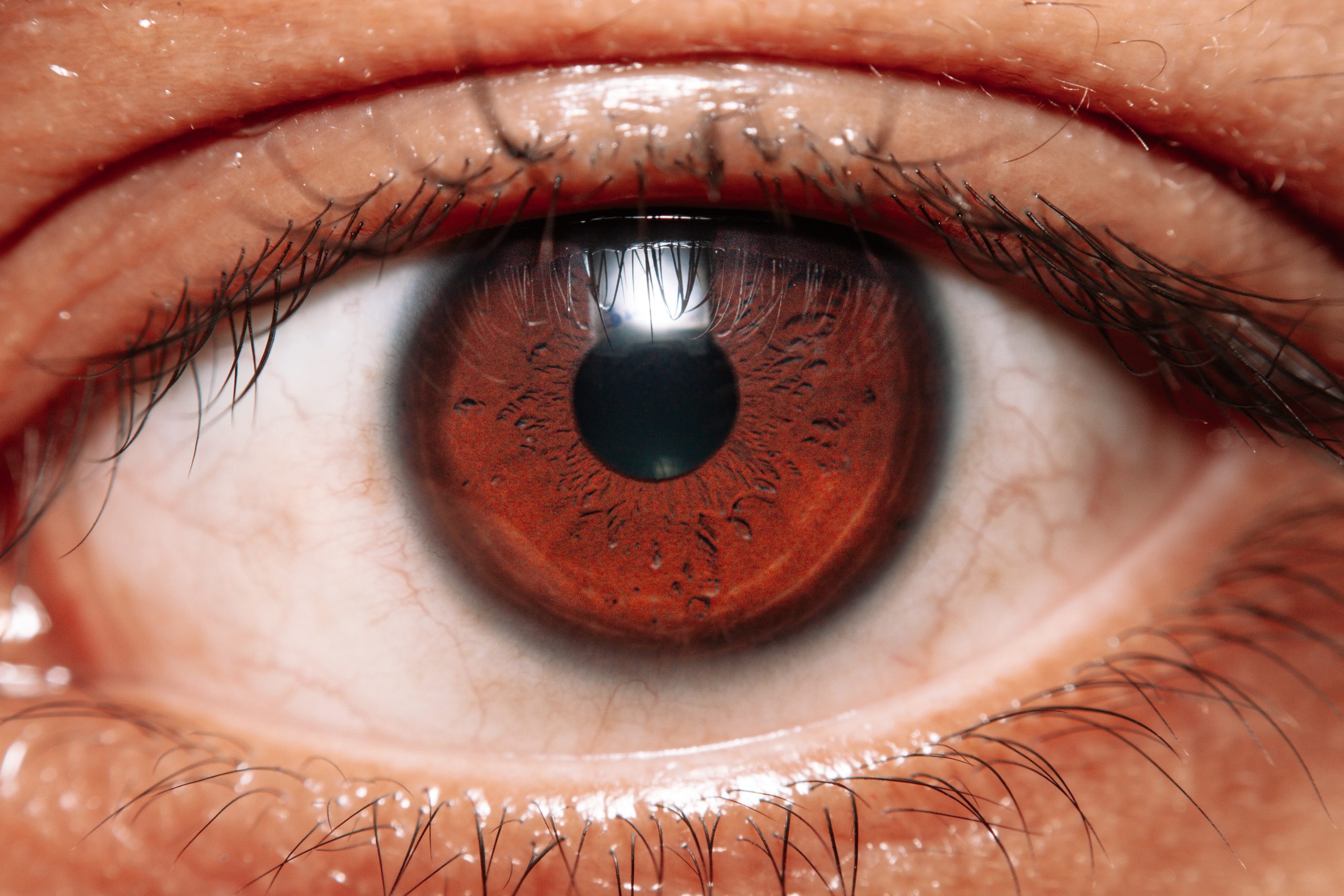 谷歌AI算法新突破: 透过视网膜就知道你会不会得心脏病!
